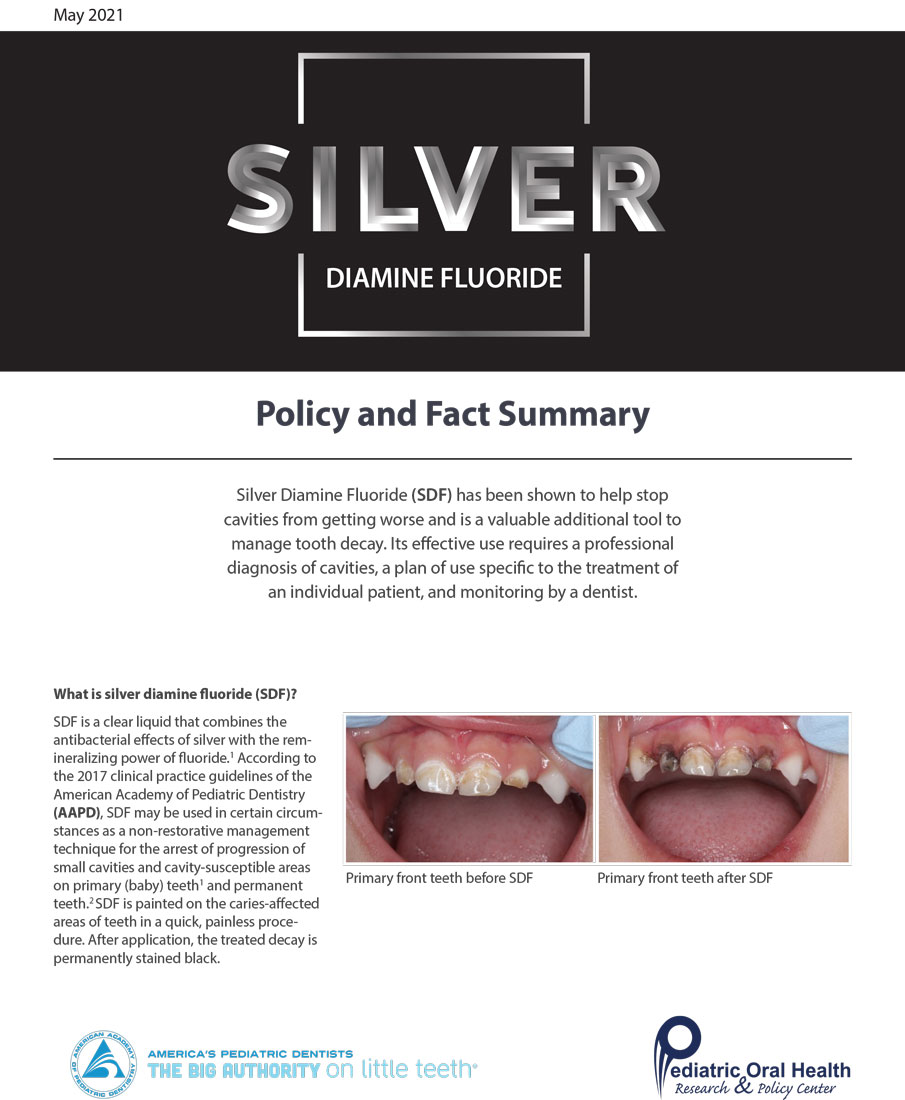 Silver Diamine Fluoride (SDF)