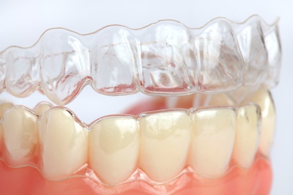 Ask An Orthodontist: Can Clear Aligners Work For People Of All Ages?