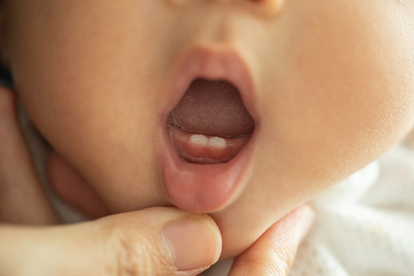 Oral Hygiene Tips From A Pediatric Dentist For Your Infant’s First Teeth