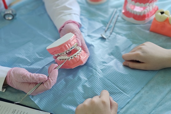 Different Types Of Orthodontic Treatment