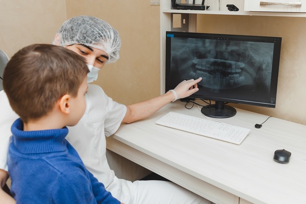 Pediatric Dental X Rays: Common Questions Answered
